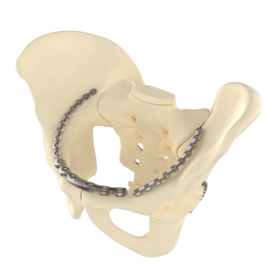 CANWELL Stainless Steel Orthopedic Trauma Pelvic Locking Plate